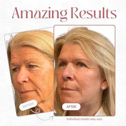 The “Calcium-Infused” Roller That Tightens “Crepey” Eyelids Without Surgery